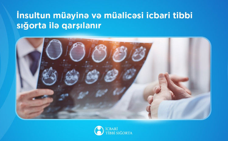 İnsultun müayinə və müalicəsi icbari tibbi sığorta ilə qarşılanır 