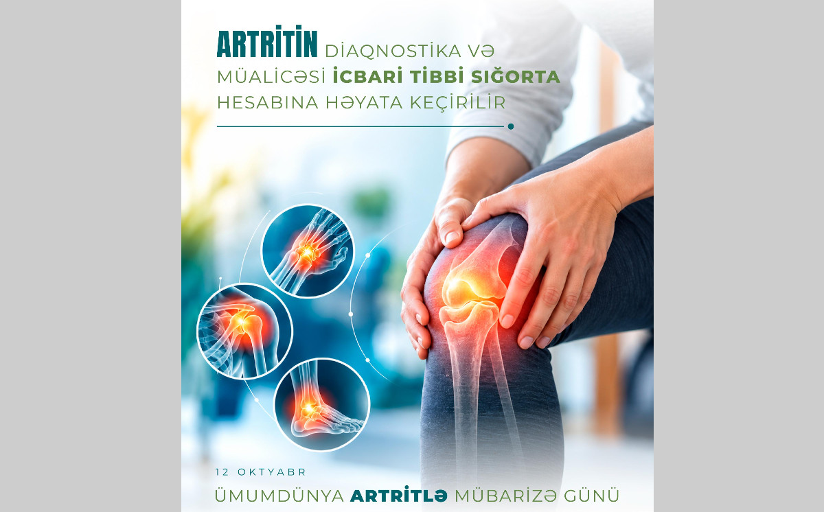 Artritin diaqnostika və müalicəsi icbari tibbi sığorta hesabına həyata keçirilir 